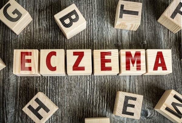 Natural Treatment Options For Eczema