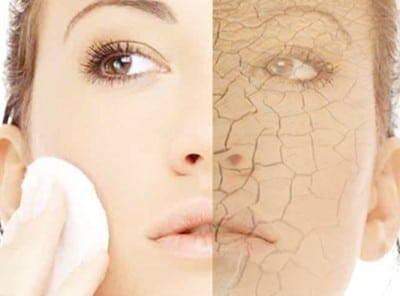 Say Goodbye To Scaly Skin