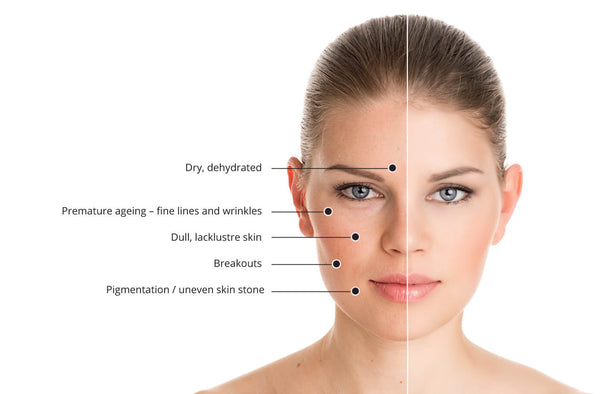 De-Stress Skin Remedies