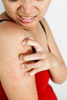 Ditch The Itch:  The Best Natural Ways To Heal Eczema And Enjoy Skin Health