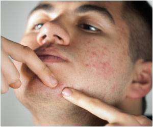 Shouldn't Squeeze Pimples