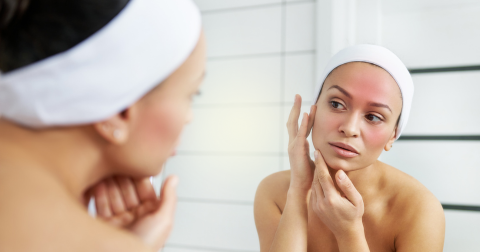 5 skincare ingredients to avoid for sensitive skin