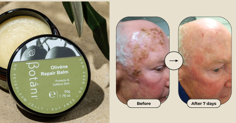 Skin Transformation Rash