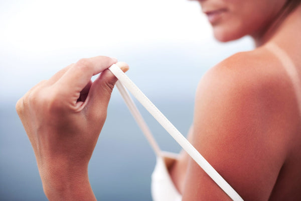 Fast Sunburn Relief Remedies