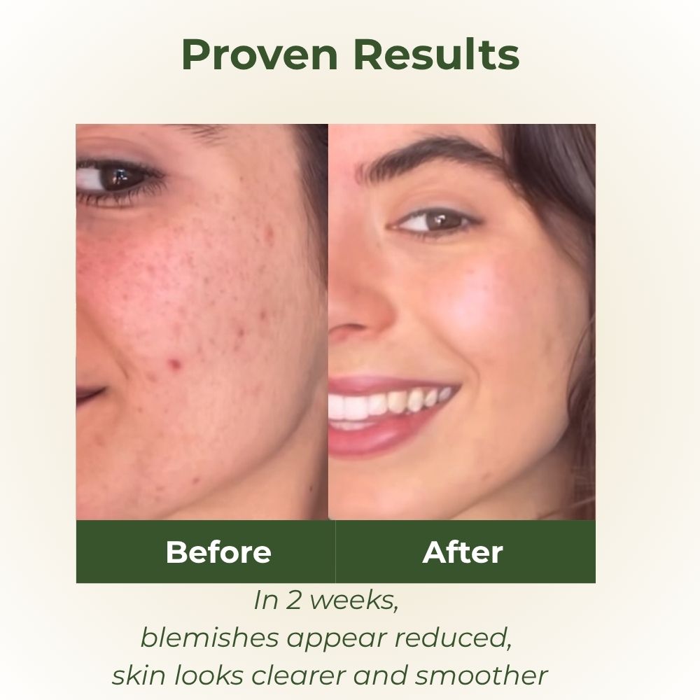 Purify Facial Cleanser before and after
