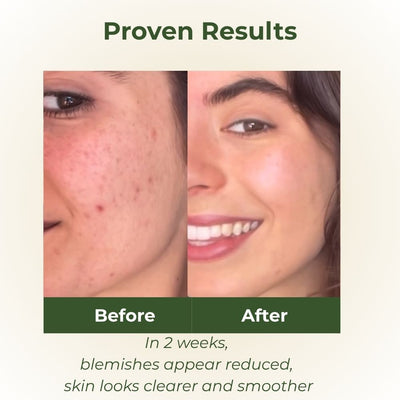 Purify Facial Cleanser before and after
