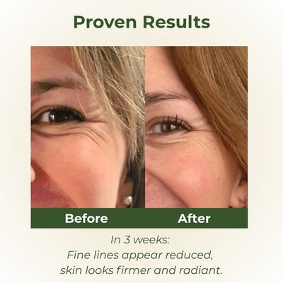 Before and after collagen serum